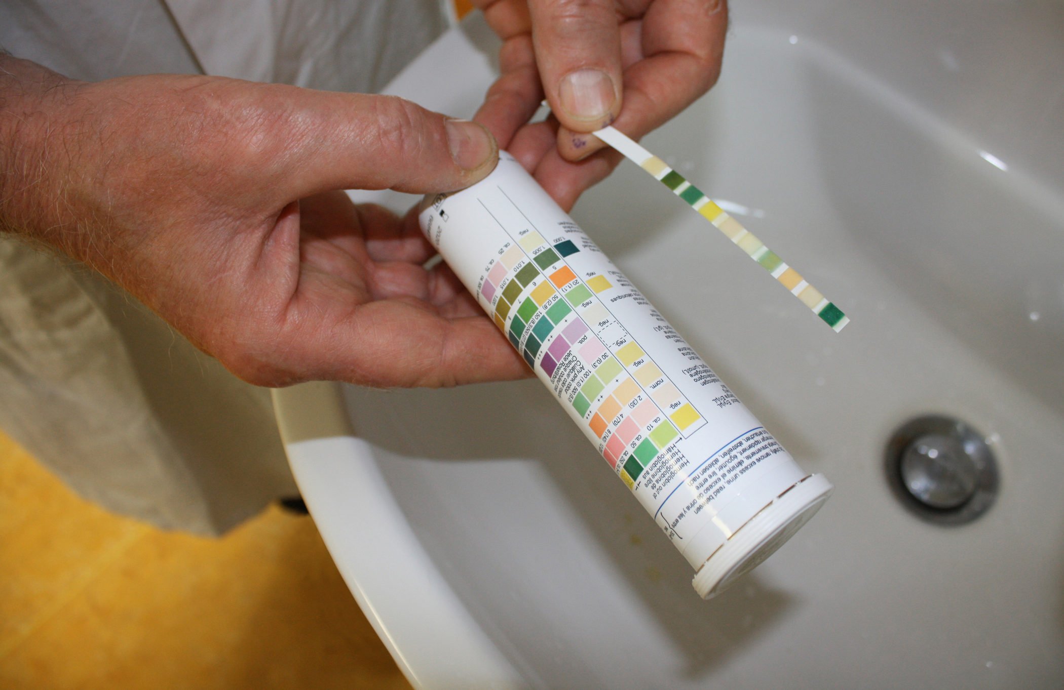 Hände des Tierarztes halten ein Röhrchen und einen Urin-Teststreifen über einem Waschbecken